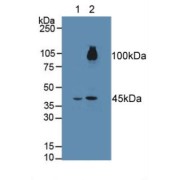 abx104529