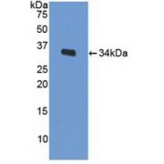 abx104532
