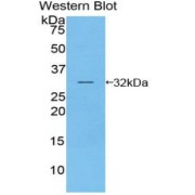 Western blot analysis of the recombinant protein.