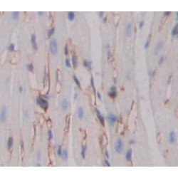 1-Phosphatidylinositol 3-Phosphate 5-Kinase (PIKFYVE) Antibody