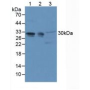 Western blot analysis of (1) Mouse Brain Tissue, (2) Mouse Cerebellum Tissue and (3) Mouse Lung Tissue.