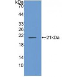 Acidic Nuclear Phosphoprotein 32 Family, Member A (ANP32A) Antibody