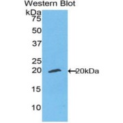 Western blot analysis of recombinant Human ENPP1.