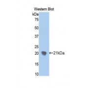 Western blot analysis of recombinant Human ENPP1 Protein.