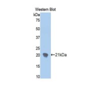 Western blot analysis of recombinant Human ENPP1 Protein.