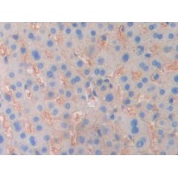 Ectonucleotide Pyrophosphatase/Phosphodiesterase 1 (ENPP1) Antibody