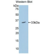 Western blot analysis of the recombinant protein.