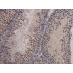 Signal Transducer And Activator of Transcription 1 (STAT1) Antibody