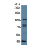 Western blot analysis of Human K562 cell lysate, using Human STAT2 Antibody (3 µg/ml) and HRP-conjugated Goat Anti-Rabbit antibody (<a href="https://www.abbexa.com/index.php?route=product/search&amp;search=abx400043" target="_blank">abx400043</a>, 0.2 µg/ml).