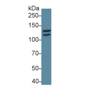 Western blot analysis of Mouse Cerebrum lysate, using Mouse STAT2 Antibody (1 µg/ml) and HRP-conjugated Goat Anti-Rabbit antibody (<a href="https://www.abbexa.com/index.php?route=product/search&amp;search=abx400043" target="_blank">abx400043</a>, 0.2 µg/ml).