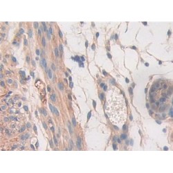 Signal Transducer And Activator of Transcription 2 (STAT2) Antibody