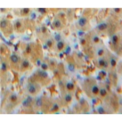 Signal Transducer And Activator of Transcription 2 (STAT2) Antibody