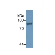 Western blot analysis of Human Jurkat cell lysate, using Human STAT4 Antibody (2 µg/ml) and HRP-conjugated Goat Anti-Rabbit antibody (<a href="https://www.abbexa.com/index.php?route=product/search&amp;search=abx400043" target="_blank">abx400043</a>, 0.2 µg/ml).