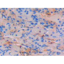 Signal Transducer And Activator of Transcription 4 (STAT4) Antibody