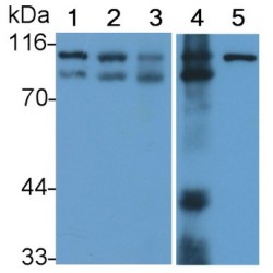 Signal Transducer And Activator of Transcription 6 (STAT6) Antibody