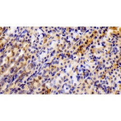 Signal Transducer And Activator of Transcription 6 (STAT6) Antibody