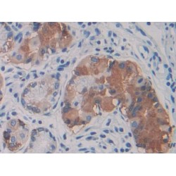 Von Willebrand Factor A Domain Containing Protein 1 (vWA1) Antibody