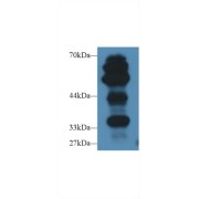 abx104578