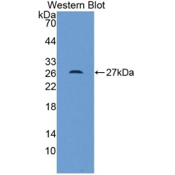 Advanced Glycosylation End Product Specific Receptor (AGER) Antibody