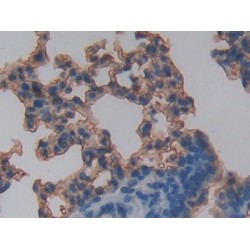 Advanced Glycosylation End Product Specific Receptor (AGER) Antibody