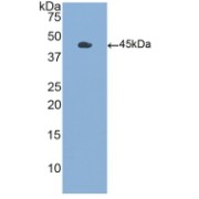 Western blot analysis of recombinant Human CSF2.