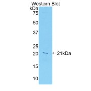 Western blot analysis of the recombinant protein.