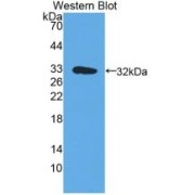 Western blot analysis of the recombinant protein.