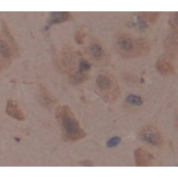 Chondroitin Sulfate Proteoglycan 4 / MCSP (CSPG4) Antibody