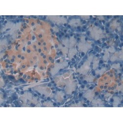 Chondroitin Sulfate Proteoglycan 4 / MCSP (CSPG4) Antibody