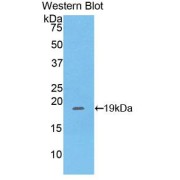 Western blot analysis of the recombinant protein.