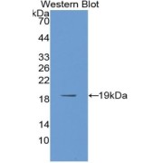 Western blot analysis of the recombinant protein.