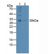 abx104600