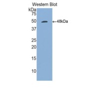 abx104601