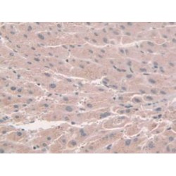 Nicotinamide Adenine Dinucleotide Phosphate Oxidase 1 (NOX1) Antibody