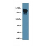Western blot analysis of Rat Serum, using Rat PIK3C2b Antibody (1 µg/ml) and HRP-conjugated Goat Anti-Rabbit antibody (<a href="https://www.abbexa.com/index.php?route=product/search&amp;search=abx400043" target="_blank">abx400043</a>, 0.2 µg/ml).
