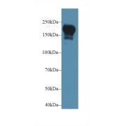 Western blot analysis of Rat Serum, using Rat PIK3C2b Antibody (1 µg/ml) and HRP-conjugated Goat Anti-Rabbit antibody (<a href="https://www.abbexa.com/index.php?route=product/search&amp;search=abx400043" target="_blank">abx400043</a>, 0.2 µg/ml).