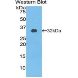 Phosphoinositide-3-Kinase Class-2-Beta Polypeptide (PIK3C2b) Antibody