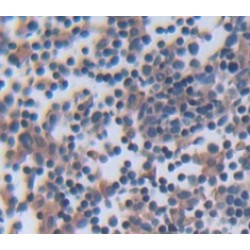 Phosphoinositide-3-Kinase Class-2-Beta Polypeptide (PIK3C2b) Antibody