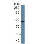 Western blot analysis of Human K562 cell lysate, using Human STAT5A Antibody (2 µg/ml) and HRP-conjugated Goat Anti-Rabbit antibody (<a href="https://www.abbexa.com/index.php?route=product/search&amp;search=abx400043" target="_blank">abx400043</a>, 0.2 µg/ml).