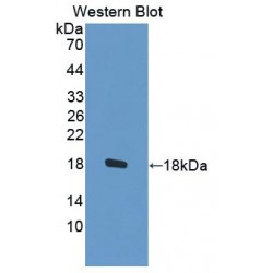 Signal Transducer And Activator of Transcription 5A (STAT5A) Antibody