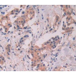 Signal Transducer And Activator of Transcription 5A (STAT5A) Antibody