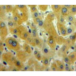 Calcium/Calmodulin Dependent Protein Kinase II Gamma (CAMK2g) Antibody