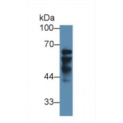 Western blot analysis of Human Liver lysate, using Human IGF2BP2 Antibody (3 µg/ml) and HRP-conjugated Goat Anti-Rabbit antibody (<a href="https://www.abbexa.com/index.php?route=product/search&amp;search=abx400043" target="_blank">abx400043</a>, 0.2 µg/ml).