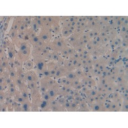 Insulin Like Growth Factor 2 mRNA Binding Protein 2 (IGF2BP2) Antibody