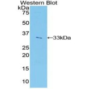 Western blot analysis of the recombinant protein.