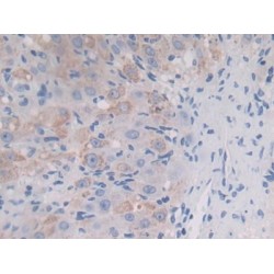 Insulin Like Growth Factor 2 mRNA Binding Protein 2 (IGF2BP2) Antibody