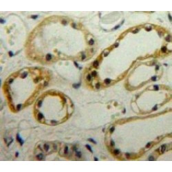 LIM And Senescent Cell Antigen Like Domains Protein 1 (LIMS1) Antibody