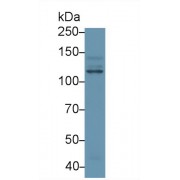 Western blot analysis of Human HeLa cell lysate, using Human PIK3Cb Antibody (1 µg/ml) and HRP-conjugated Goat Anti-Rabbit antibody (<a href="https://www.abbexa.com/index.php?route=product/search&amp;search=abx400043" target="_blank">abx400043</a>, 0.2 µg/ml).