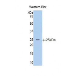 Phosphoinositide-3-Kinase Catalytic Beta Polypeptide (PIK3Cb) Antibody