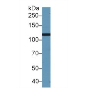 Western blot analysis of Pig Cerebrum lysate, using Human PBRM1 Antibody (2 µg/ml) and HRP-conjugated Goat Anti-Rabbit antibody (<a href="https://www.abbexa.com/index.php?route=product/search&amp;search=abx400043" target="_blank">abx400043</a>, 0.2 µg/ml).